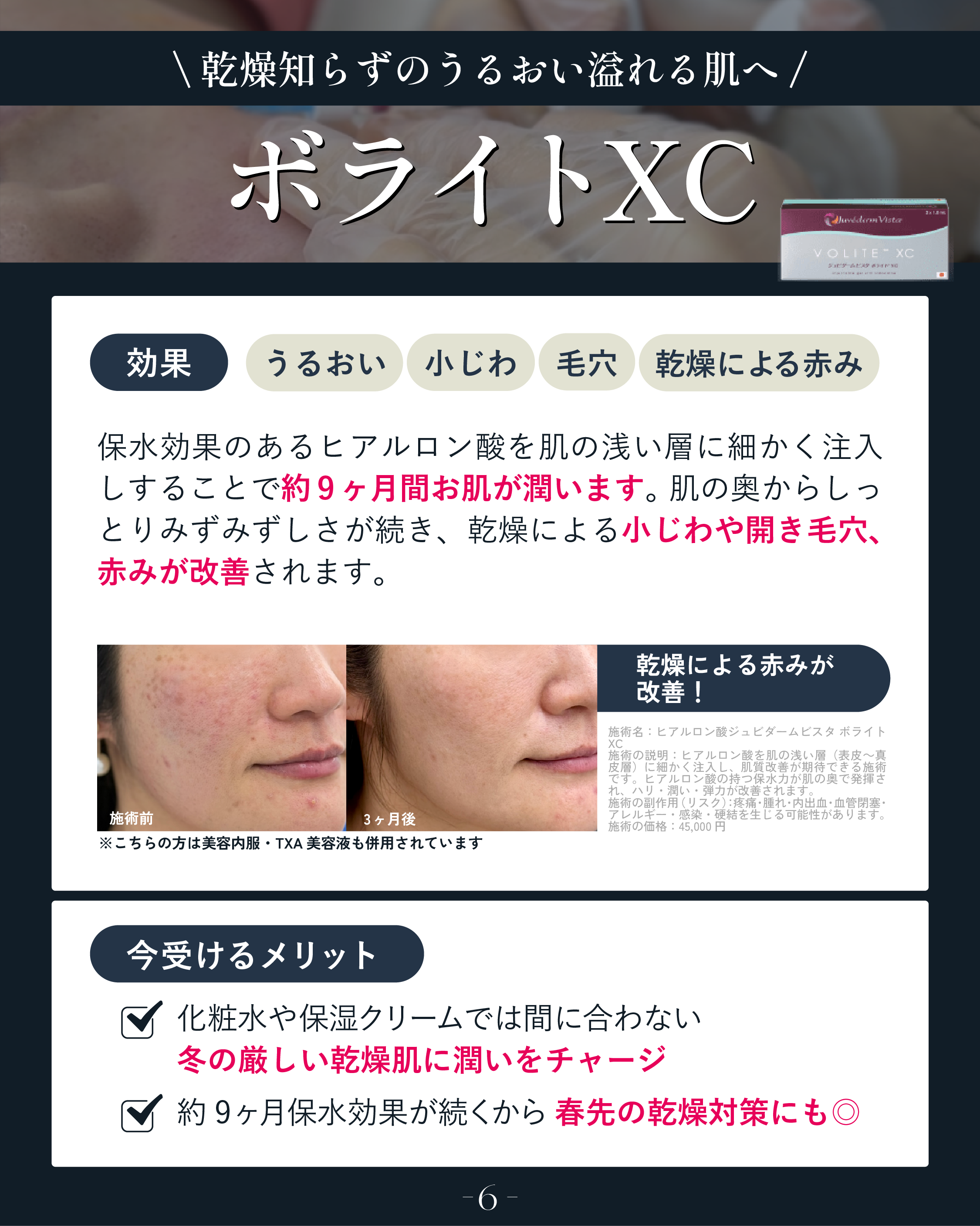 乾燥を改善したい方はこれ！