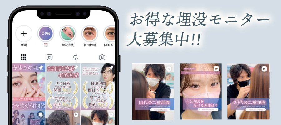 【お得モニター】土田院長による持続力とデザイン性抜群の二重埋没法！