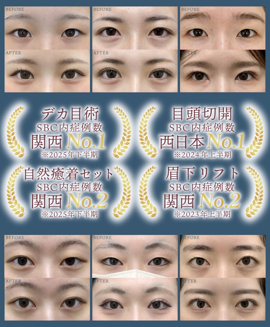 目元整形 症例数4冠達成*