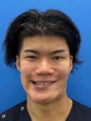 ☑mouth corners /chin