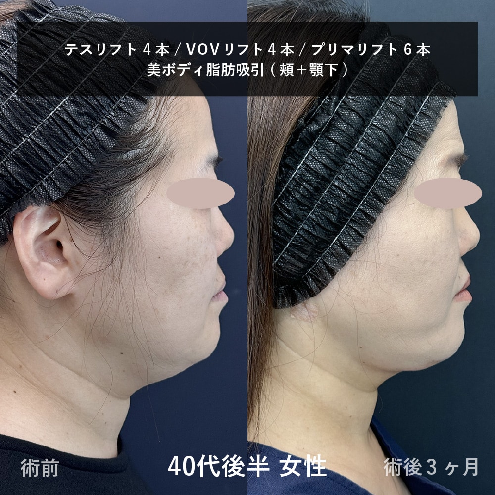 横顔・あご下の変化率に注目！