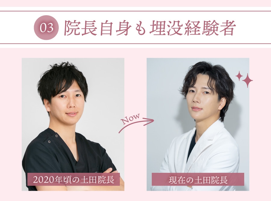 埋没経験者だからこそのこだわり