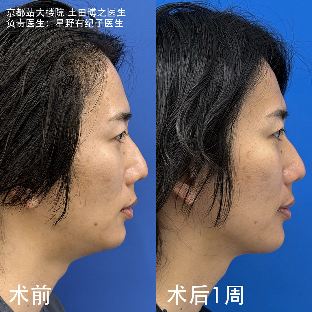 京都站大楼院院长・土田医生亲自上阵挑战！