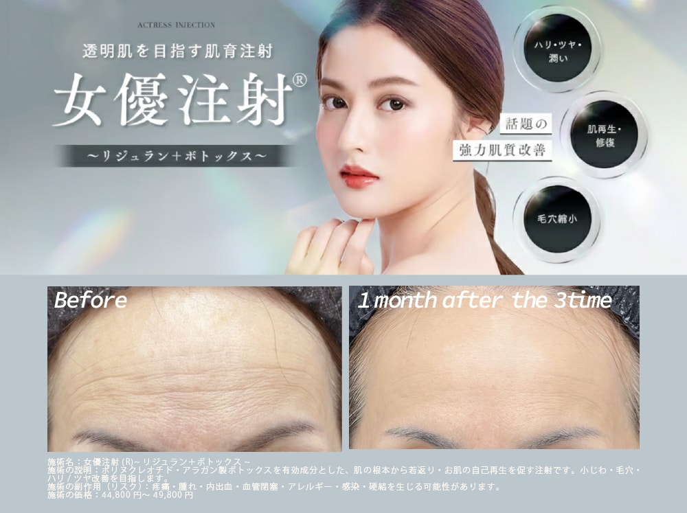 シワがすでに刻まれている場合はどうしたらいい？