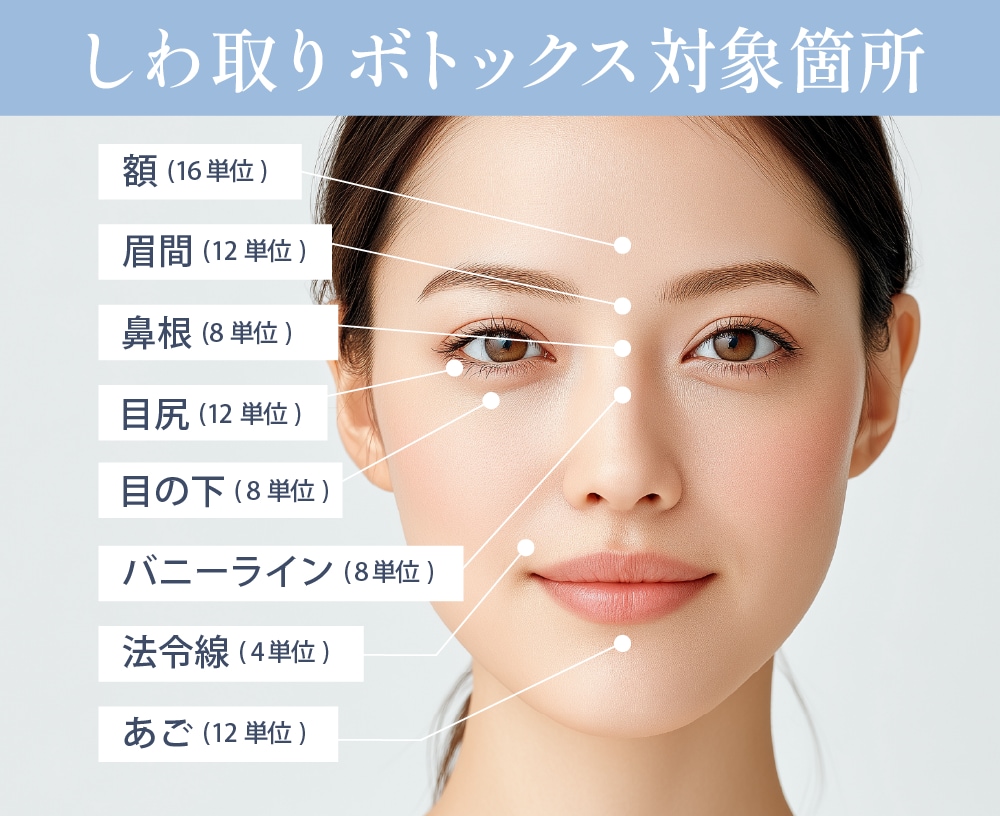 しわ取りボトックスの対象部位と注入量目安