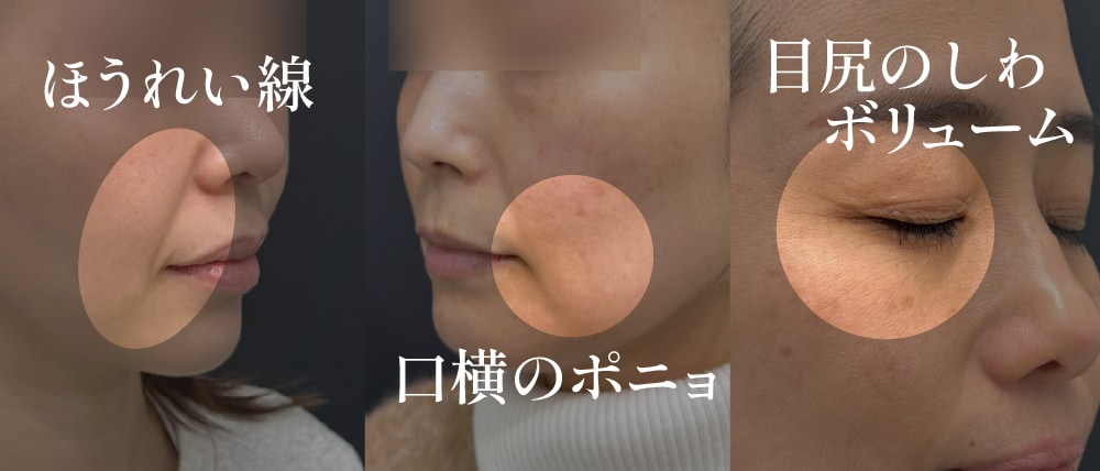 3名の女性が肌育を体験！<br />
