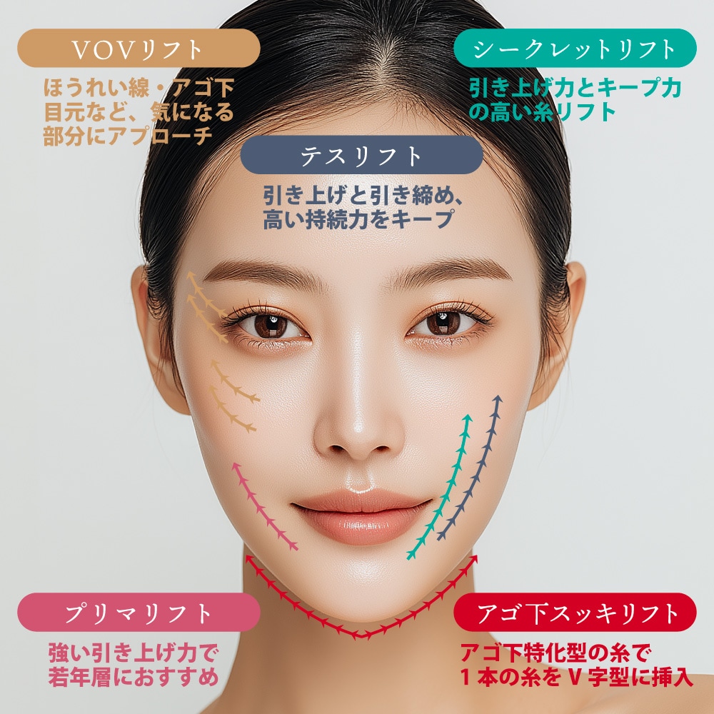 糸リフトってどんな治療？