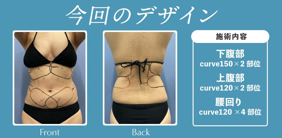 ぽっこりお腹をクルスカダブルで撃退！
