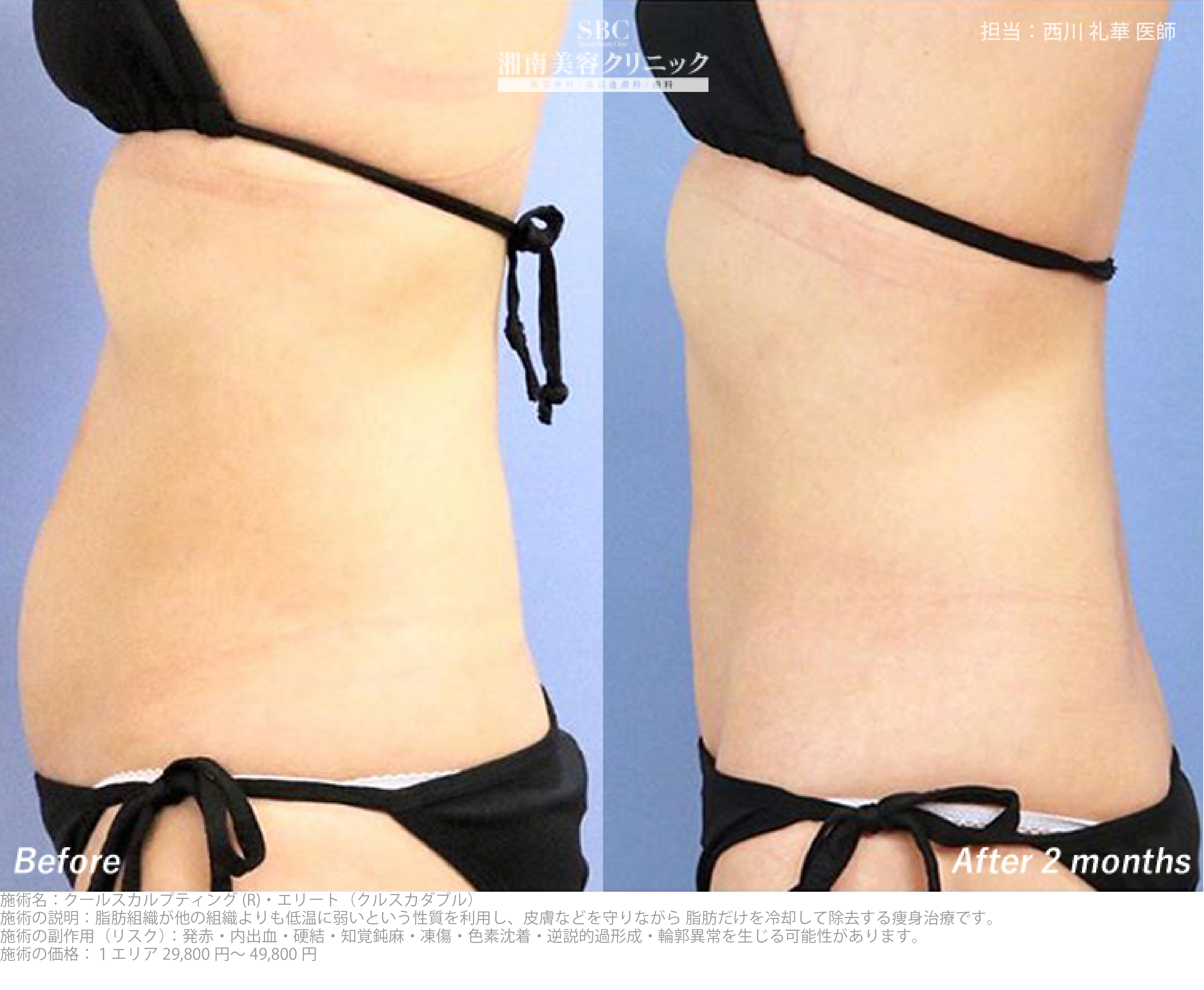 下っ腹がスッキリ！横から見た時の厚みも薄く