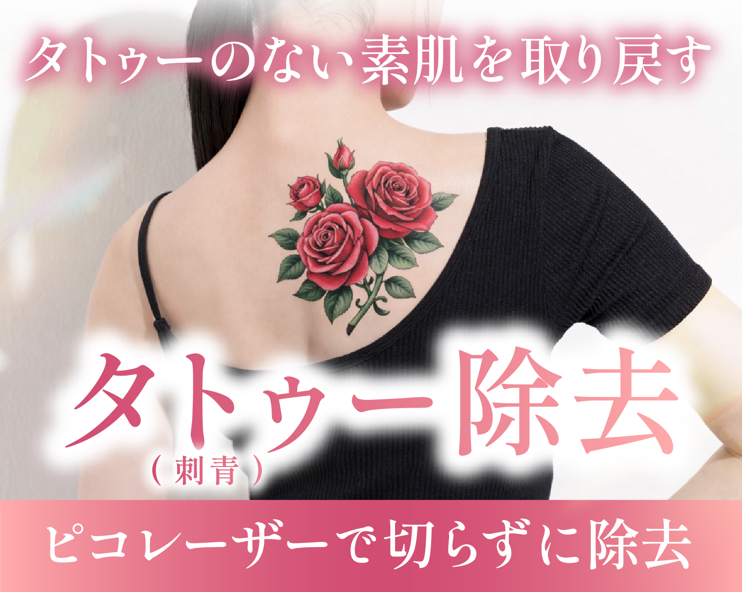 【京都でタトゥー除去・刺青除去】レーザーによるタトゥー除去ならSBC京都駅ビル院