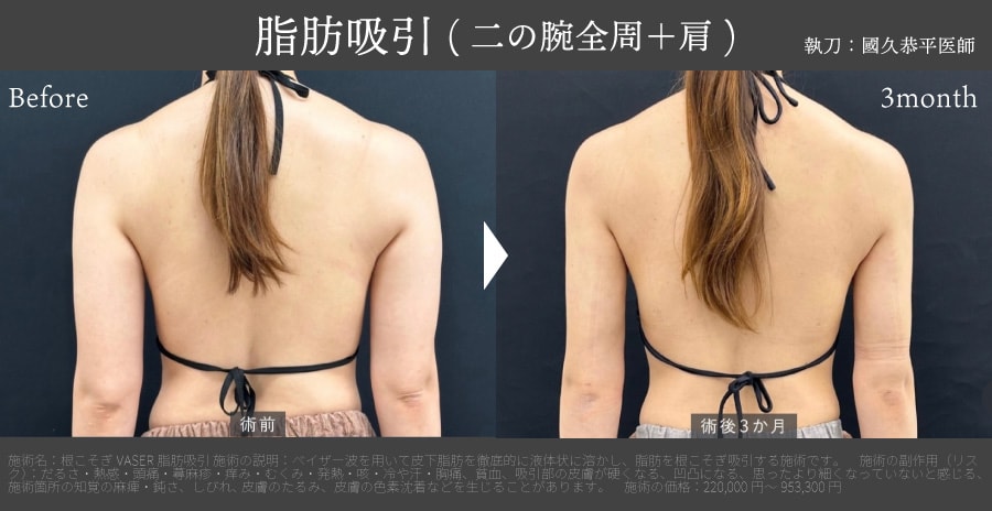 筋肉の場所を意識したボディデザイン