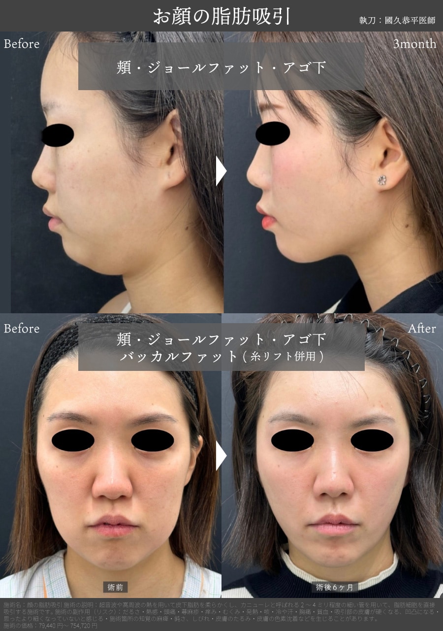 骨格に沿った「360度どこから見ても美しい」造形