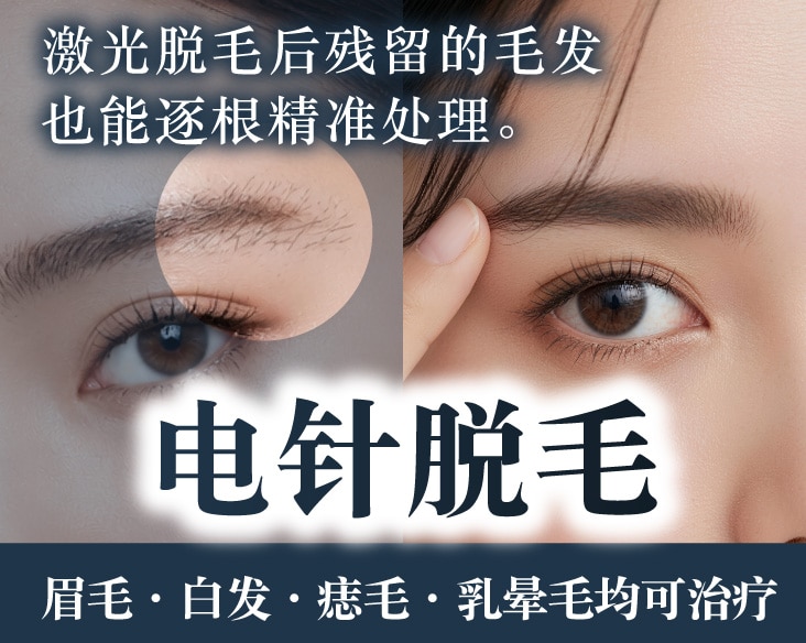【京都电针脱毛】眉毛/白发/痣上毛也能永久搞定!SBC京都站大楼院电针脱毛全解析!