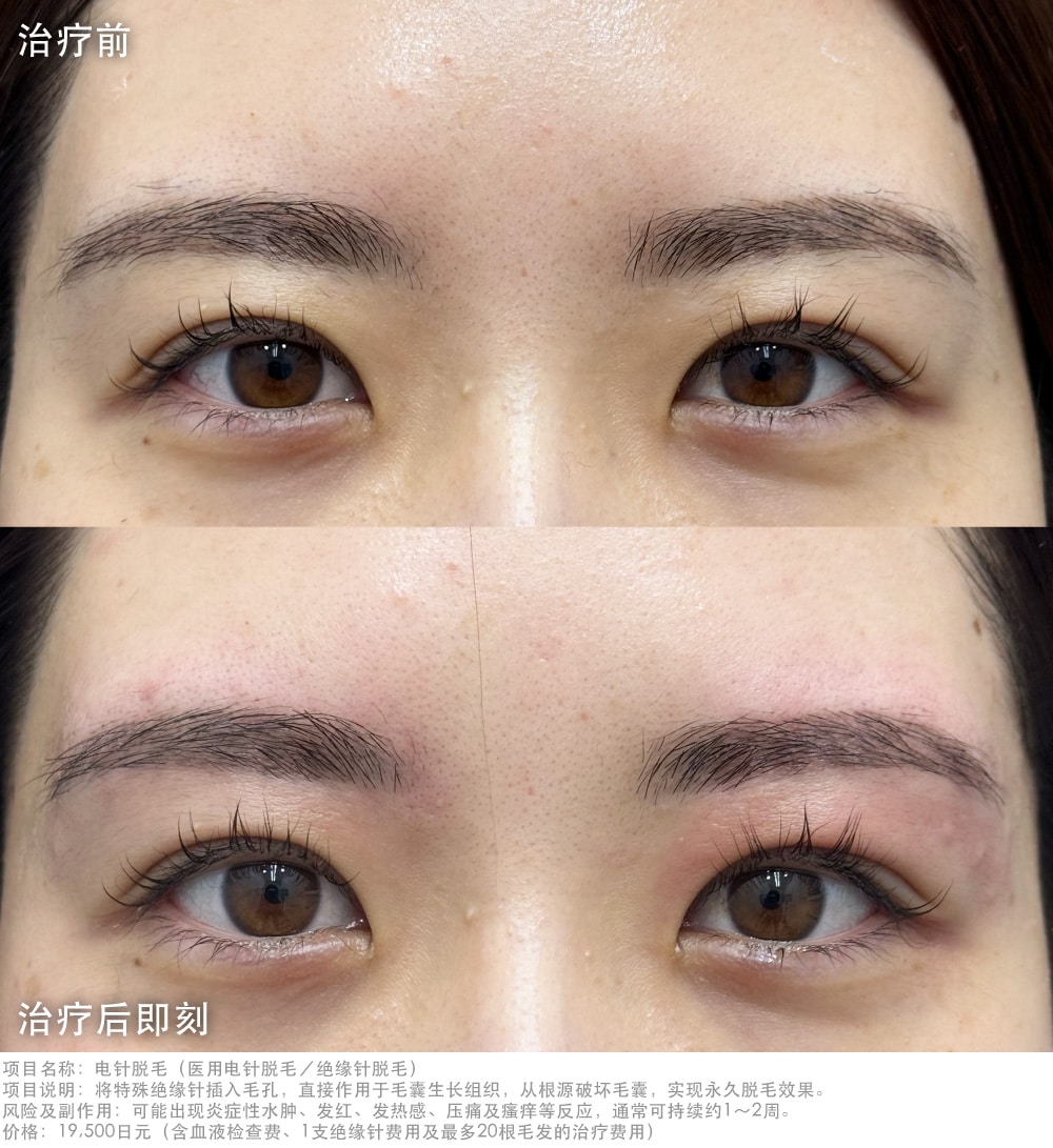 眉毛轮廓瞬间更清晰！轻松拥有更精致、更显气质的高级感眉形