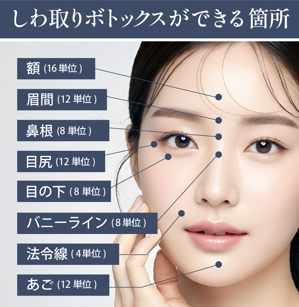 どこに打てる？しわ取りボトックスができる部位