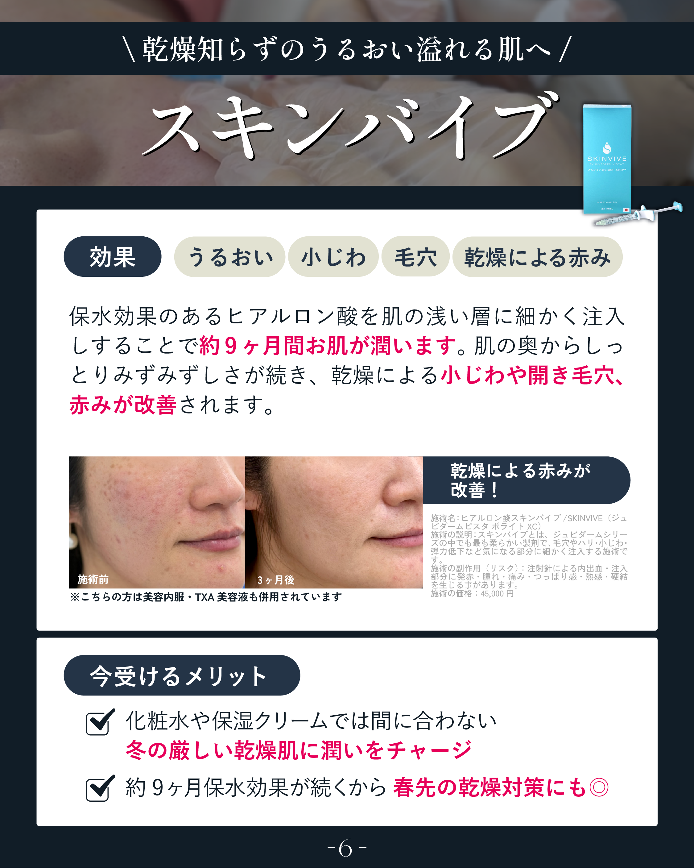 乾燥を改善したい方はこれ！