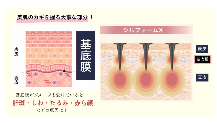 様々な肌悩みに効果を発揮するのは、「基底膜」にアプローチするから！