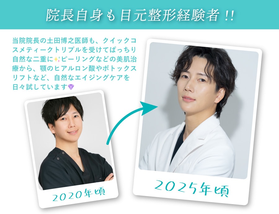 院長自身も目元整形の経験者