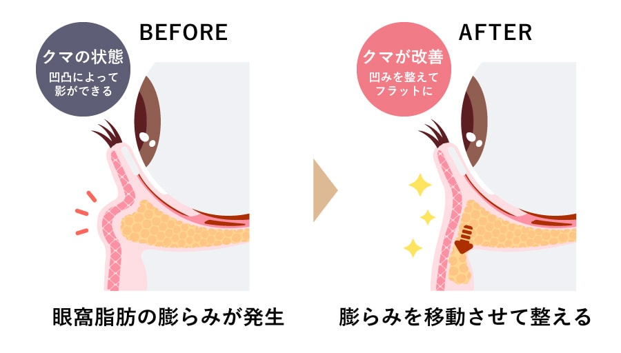 セルフケアの限界を感じたら・裏ハムラ法が選ばれる理由<br />
