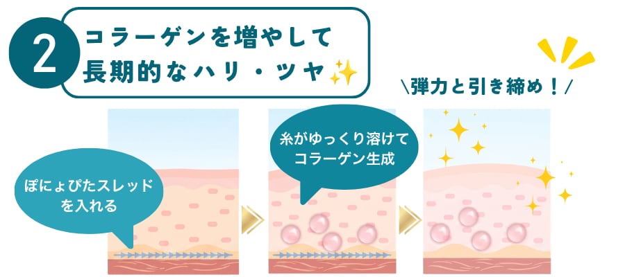 <strong style="color: #0097b2;">【コラーゲン増生で長期的なハリ・ツヤ】 </strong> 