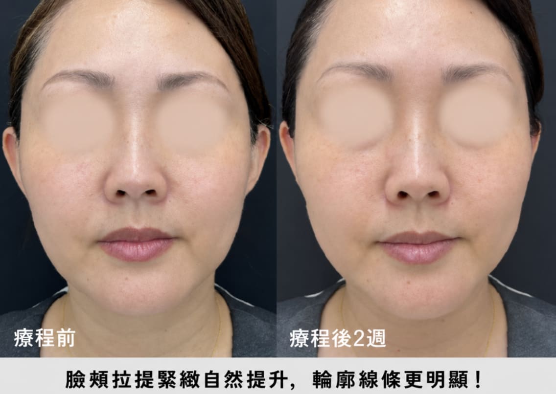 30歲後半工作人員的實際案例