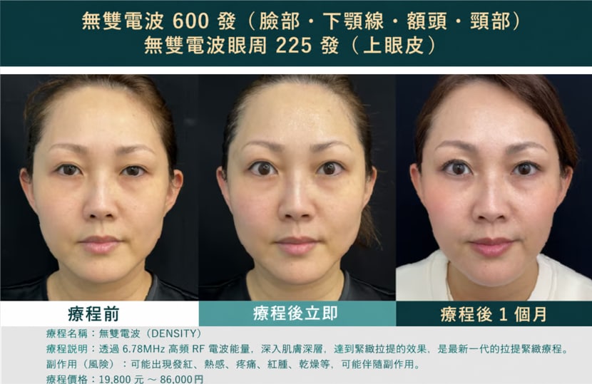 30多歲女性工作人員的實際案例