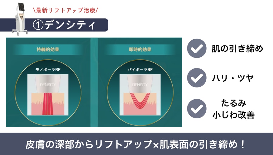 その①デンシティ