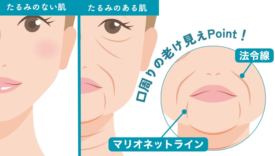 口周りの老け見えポイント！<br />
