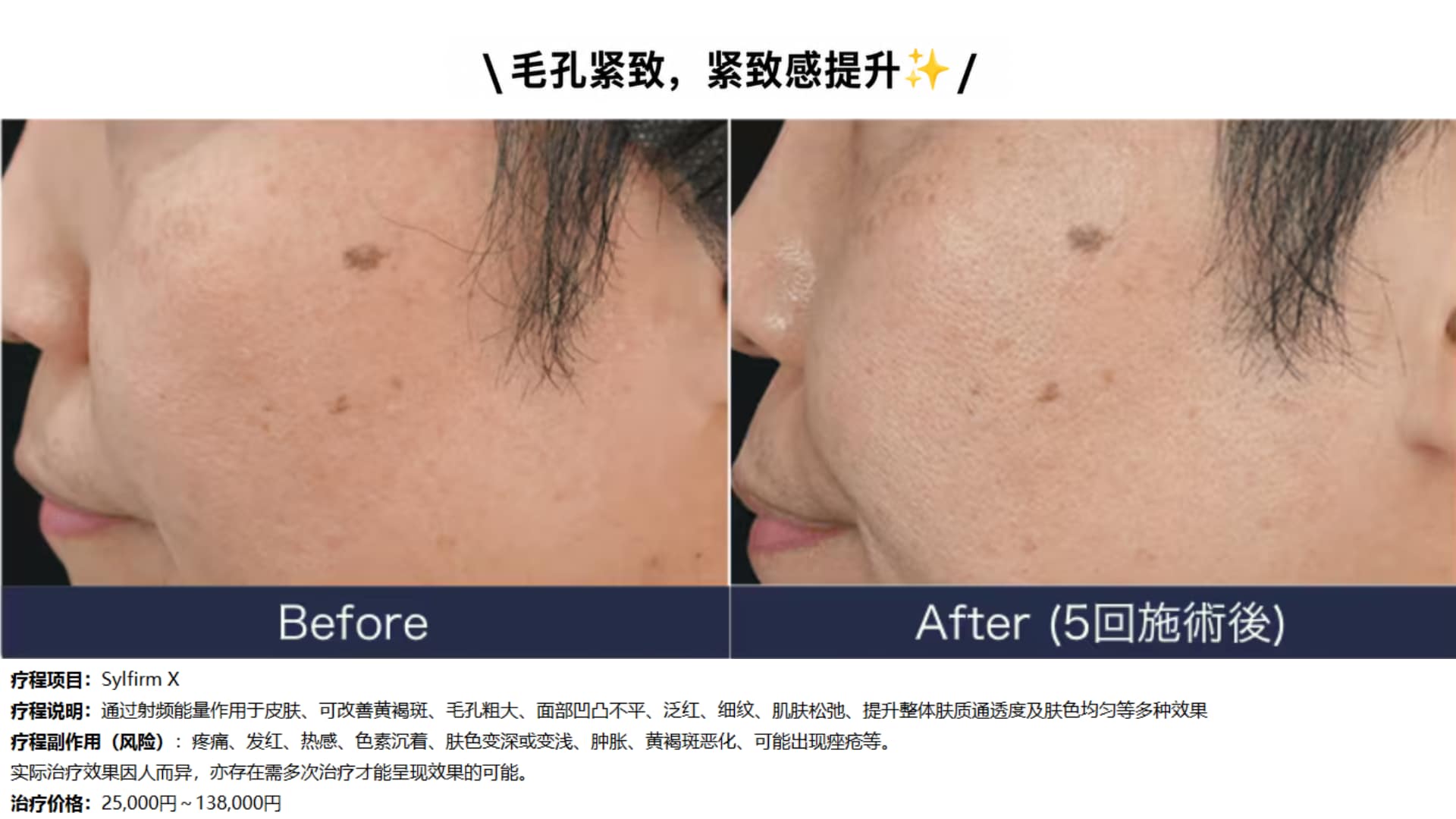 毛孔、细纹也能改善！