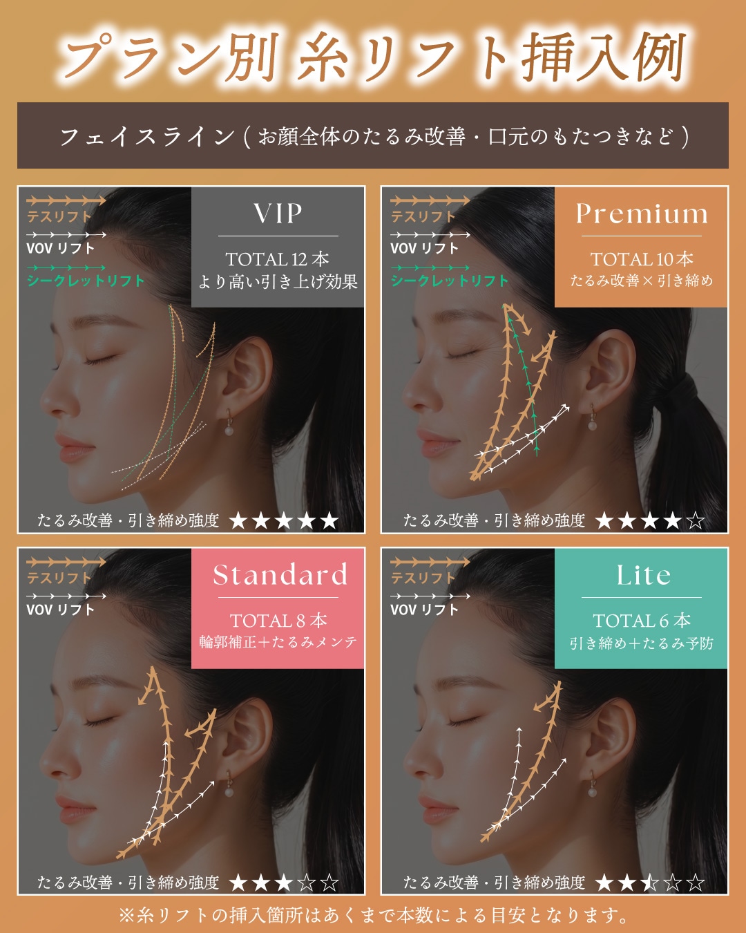 選べる4つの糸リフトプラン
