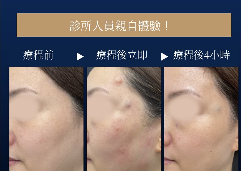 由京都站大樓院的工作人員親自接受療程！