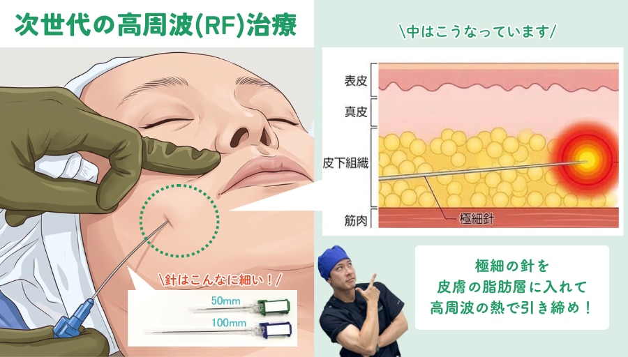 皮膚内部から狙った部位を引き締める<br />
