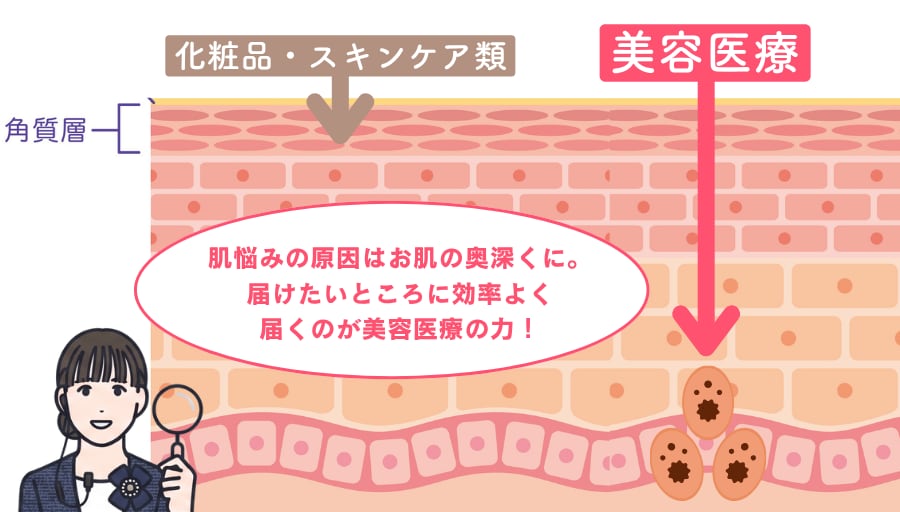 化粧品では難しい、奥深くへ効率よくアプローチを