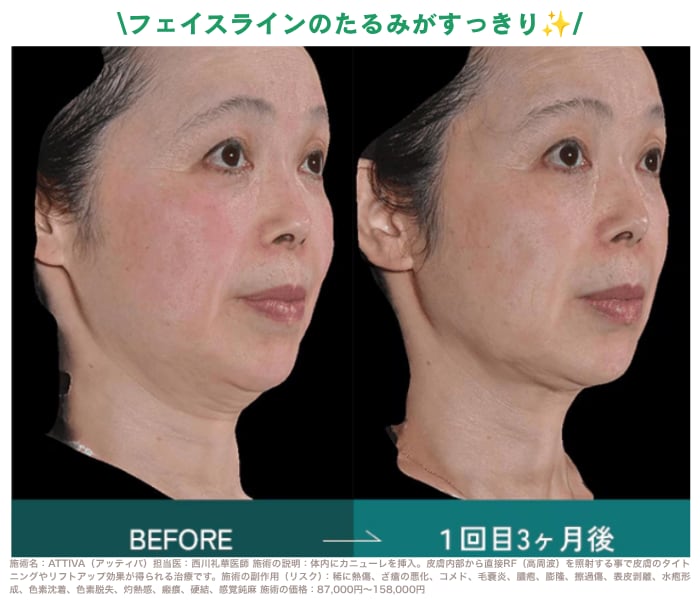 即時性と持続性のダブル効果！<br />
