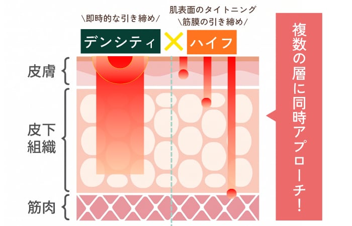 タイトニング×リフトアップでさらなる効果アップ！