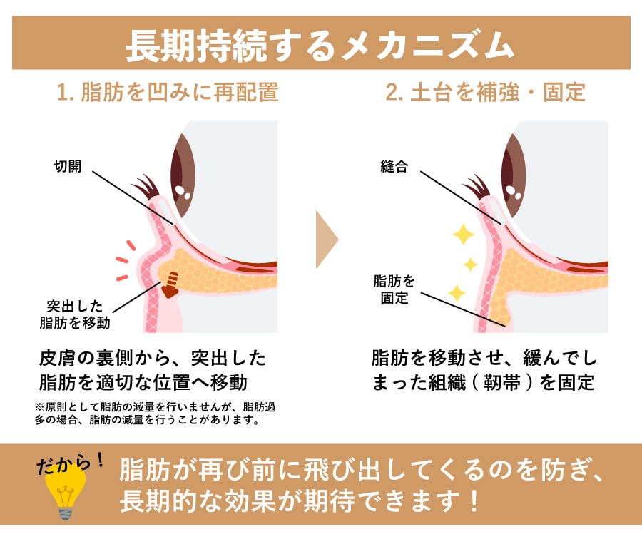 効果の持続性と「再発」のリスクについて