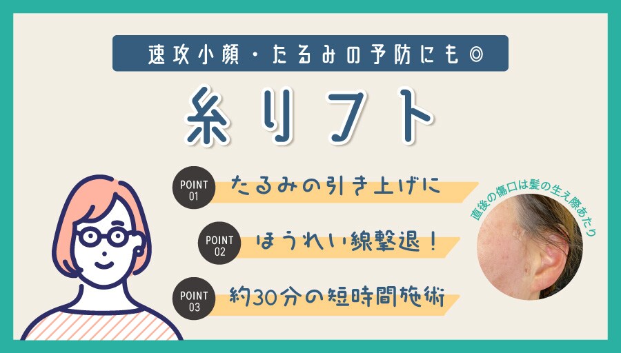 短時間で速攻リフトアップ!