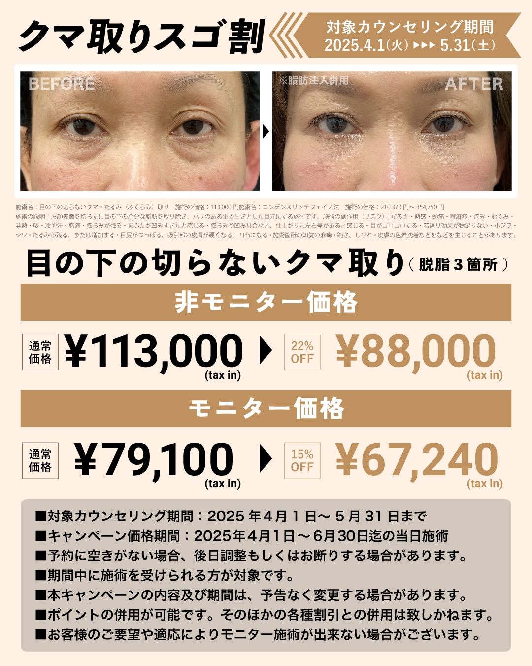 原田医師のクマ取りが最大22％OFF！