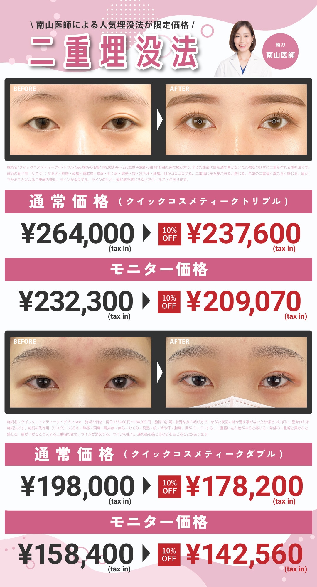 南山医師の埋没法が10%OFF!