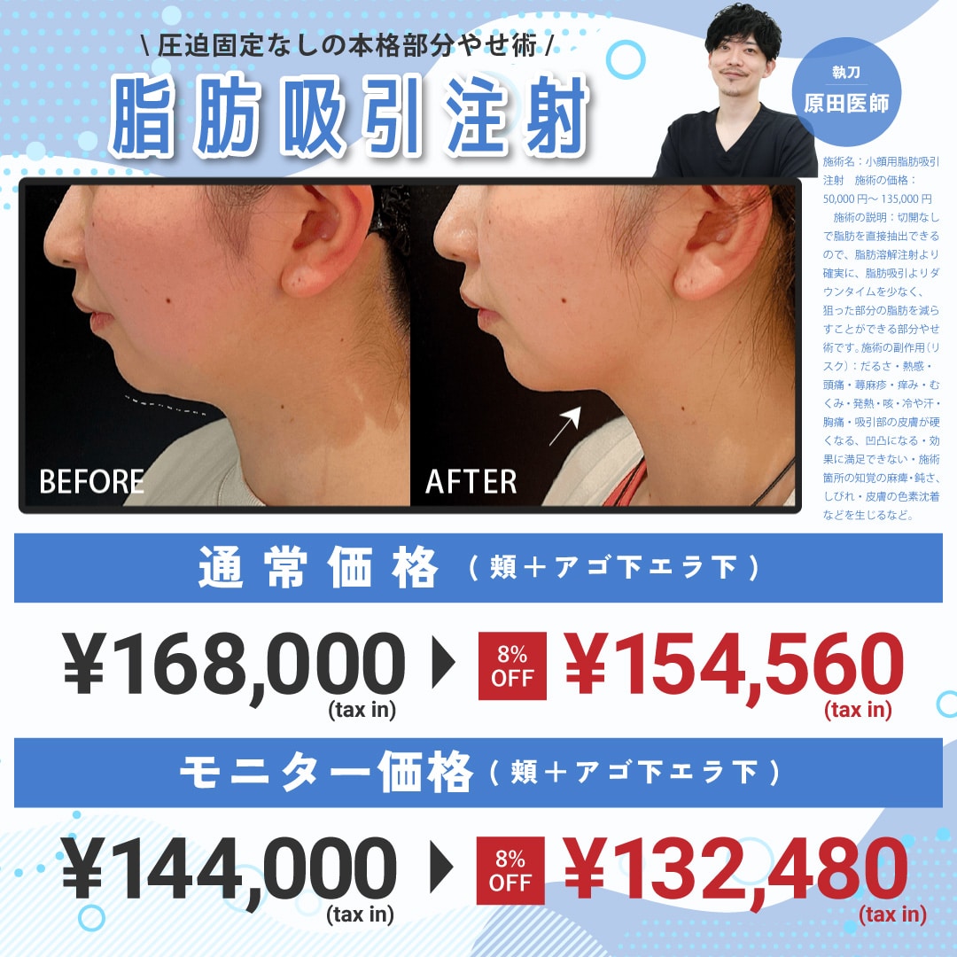 人気小顔治療がお得に!