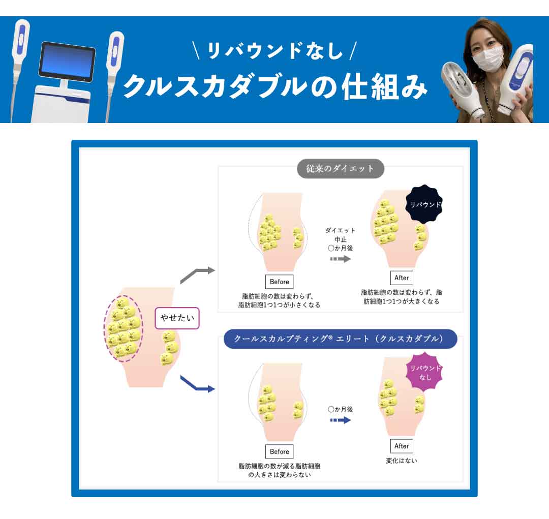 リバウンドなしで部分痩せが叶う♪