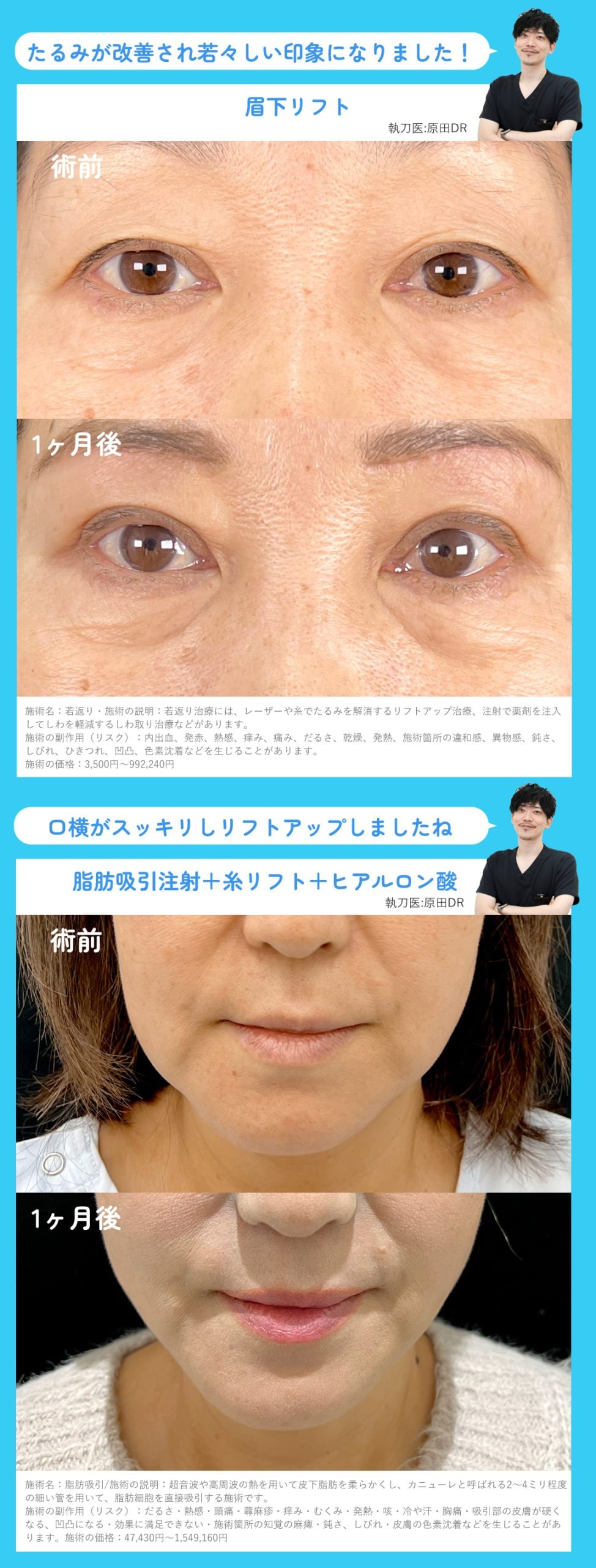 若返り・小顔術の症例