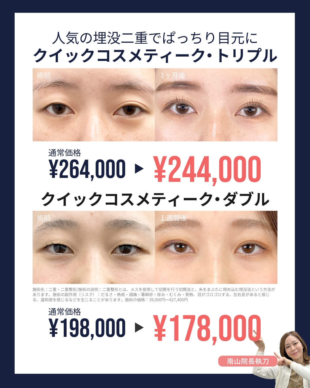人気の埋没法が2万円OFF