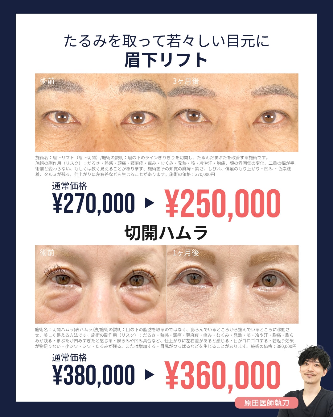 若返りメニューも2万円OFF