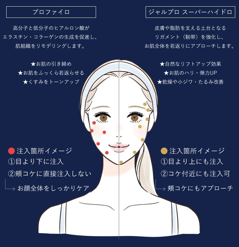 プロファイロとの使い分け