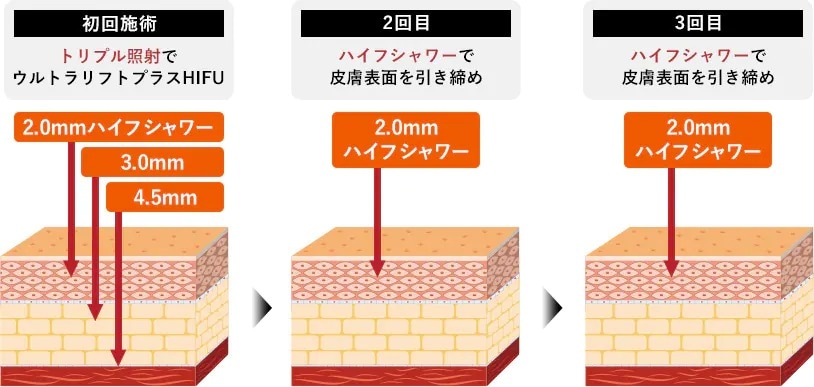 【新登場！】プレミアムセットとは？