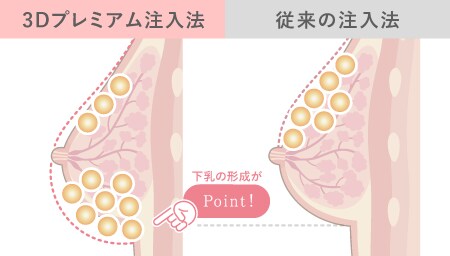 ふっくら下乳で自然な仕上がりに。