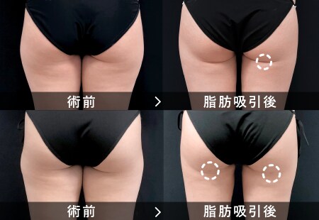 傷跡を目立たせない取り組み
