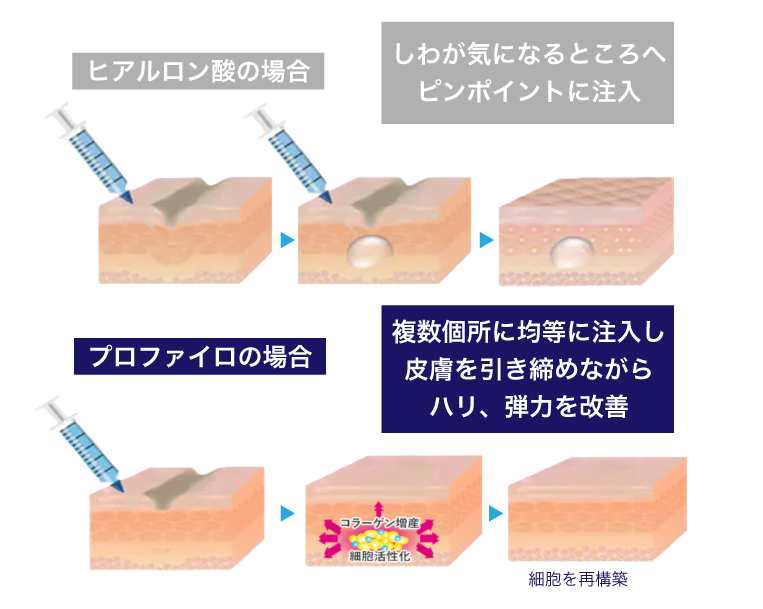 これまでのヒアルロン酸と何が違うの？