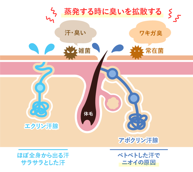 ミラドライはどんな汗に効果があるの？